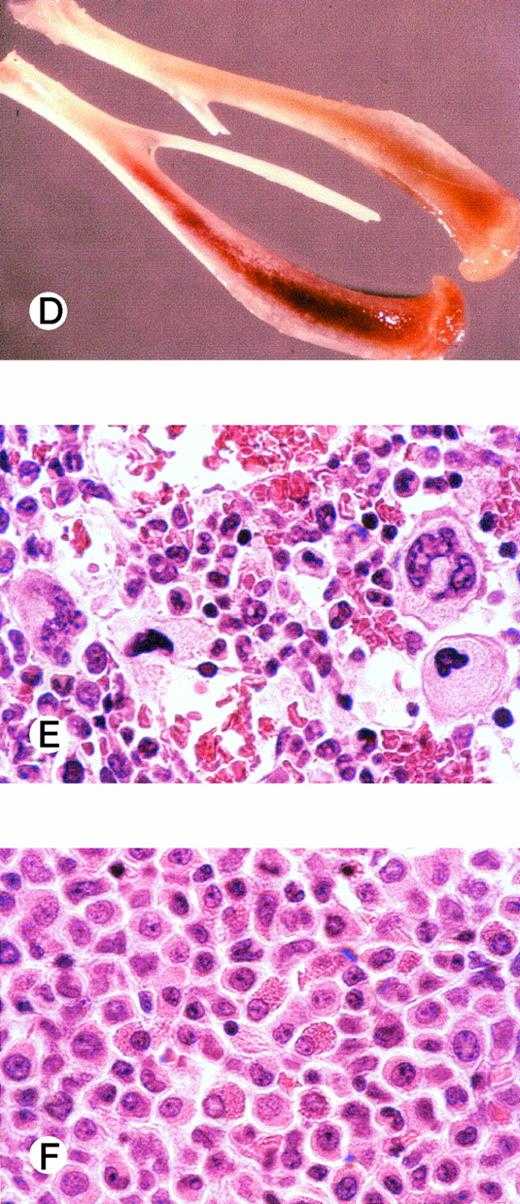 Fig. 3. Flow cytometric analysis of (A) BM, (B) spleen, and (C) PB of an animal transplanted with 25 × 106G-CSF–mobilized human peripheral blood CD34+ cells. The percentage of human cells (CD45+ and mCD18−) is indicated in the graphs. The spleen of this animal was enlarged as compared with control (17 × 106 v 5.4 × 106 cells). In (D), humerus of this animal (top) as compared with the humerus of an irradiated nontransplanted control animal (bottom). In (E) and (F), histology (hematoxylin and eosin stain) of the bone marrow of control and transplanted animal, respectively.