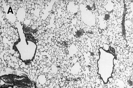 Fig. 1. Allogeneic transplant recipients with GVHD showed increased pathology. Photomicrographs of lung sections stained with hematoxylin and eosin show evidence of increased pathology in infected allogeneic GVHD mice. (A) Normal CBA, mock-infected, original magnification × 25; (B) normal CBA, mock-infected, original magnification × 100; (C) normal CBA, infected, original magnification × 40; (D) normal CBA, infected, original magnification × 100; (E) allogeneic GVHD, mock-infected, original magnification × 10; (F) allogeneic GVHD, mock-infected, original magnification × 75; (G) allogeneic GVHD, infected, original magnification × 10; (H) allogeneic GVHD, infected, original magnification × 100.