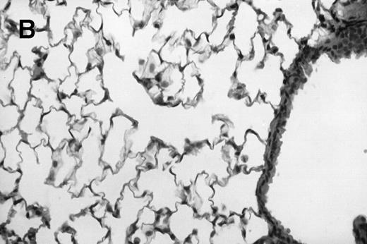 Fig. 1. Allogeneic transplant recipients with GVHD showed increased pathology. Photomicrographs of lung sections stained with hematoxylin and eosin show evidence of increased pathology in infected allogeneic GVHD mice. (A) Normal CBA, mock-infected, original magnification × 25; (B) normal CBA, mock-infected, original magnification × 100; (C) normal CBA, infected, original magnification × 40; (D) normal CBA, infected, original magnification × 100; (E) allogeneic GVHD, mock-infected, original magnification × 10; (F) allogeneic GVHD, mock-infected, original magnification × 75; (G) allogeneic GVHD, infected, original magnification × 10; (H) allogeneic GVHD, infected, original magnification × 100.