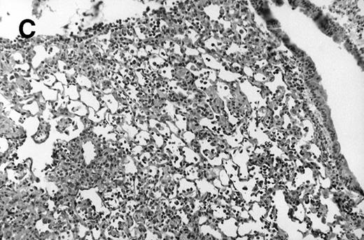 Fig. 1. Allogeneic transplant recipients with GVHD showed increased pathology. Photomicrographs of lung sections stained with hematoxylin and eosin show evidence of increased pathology in infected allogeneic GVHD mice. (A) Normal CBA, mock-infected, original magnification × 25; (B) normal CBA, mock-infected, original magnification × 100; (C) normal CBA, infected, original magnification × 40; (D) normal CBA, infected, original magnification × 100; (E) allogeneic GVHD, mock-infected, original magnification × 10; (F) allogeneic GVHD, mock-infected, original magnification × 75; (G) allogeneic GVHD, infected, original magnification × 10; (H) allogeneic GVHD, infected, original magnification × 100.