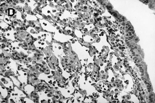 Fig. 1. Allogeneic transplant recipients with GVHD showed increased pathology. Photomicrographs of lung sections stained with hematoxylin and eosin show evidence of increased pathology in infected allogeneic GVHD mice. (A) Normal CBA, mock-infected, original magnification × 25; (B) normal CBA, mock-infected, original magnification × 100; (C) normal CBA, infected, original magnification × 40; (D) normal CBA, infected, original magnification × 100; (E) allogeneic GVHD, mock-infected, original magnification × 10; (F) allogeneic GVHD, mock-infected, original magnification × 75; (G) allogeneic GVHD, infected, original magnification × 10; (H) allogeneic GVHD, infected, original magnification × 100.