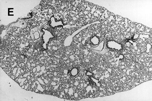 Fig. 1. Allogeneic transplant recipients with GVHD showed increased pathology. Photomicrographs of lung sections stained with hematoxylin and eosin show evidence of increased pathology in infected allogeneic GVHD mice. (A) Normal CBA, mock-infected, original magnification × 25; (B) normal CBA, mock-infected, original magnification × 100; (C) normal CBA, infected, original magnification × 40; (D) normal CBA, infected, original magnification × 100; (E) allogeneic GVHD, mock-infected, original magnification × 10; (F) allogeneic GVHD, mock-infected, original magnification × 75; (G) allogeneic GVHD, infected, original magnification × 10; (H) allogeneic GVHD, infected, original magnification × 100.