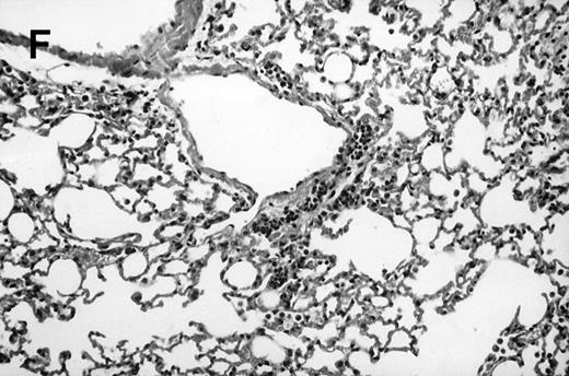 Fig. 1. Allogeneic transplant recipients with GVHD showed increased pathology. Photomicrographs of lung sections stained with hematoxylin and eosin show evidence of increased pathology in infected allogeneic GVHD mice. (A) Normal CBA, mock-infected, original magnification × 25; (B) normal CBA, mock-infected, original magnification × 100; (C) normal CBA, infected, original magnification × 40; (D) normal CBA, infected, original magnification × 100; (E) allogeneic GVHD, mock-infected, original magnification × 10; (F) allogeneic GVHD, mock-infected, original magnification × 75; (G) allogeneic GVHD, infected, original magnification × 10; (H) allogeneic GVHD, infected, original magnification × 100.