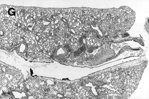 Fig. 1. Allogeneic transplant recipients with GVHD showed increased pathology. Photomicrographs of lung sections stained with hematoxylin and eosin show evidence of increased pathology in infected allogeneic GVHD mice. (A) Normal CBA, mock-infected, original magnification × 25; (B) normal CBA, mock-infected, original magnification × 100; (C) normal CBA, infected, original magnification × 40; (D) normal CBA, infected, original magnification × 100; (E) allogeneic GVHD, mock-infected, original magnification × 10; (F) allogeneic GVHD, mock-infected, original magnification × 75; (G) allogeneic GVHD, infected, original magnification × 10; (H) allogeneic GVHD, infected, original magnification × 100.