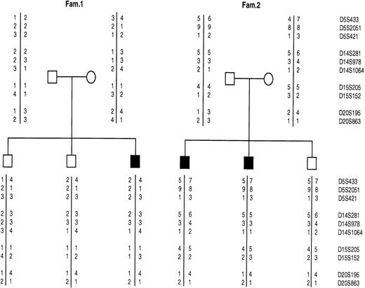 Fig. 1. Allele segregation for microsatellite markers in two CDA-II families (1 and 2): the solid squares indicate the affected individuals. The microsatellite markers are tightly linked to the following genes: MANA, mapping on chromosome 5 (5q2.1-2.2); MANAx isozyme, mapping on chromosome 15q25; Gnt-II mapping on chromosome 14q21 and CDAN2 mapping on chromosome 20q11.2.