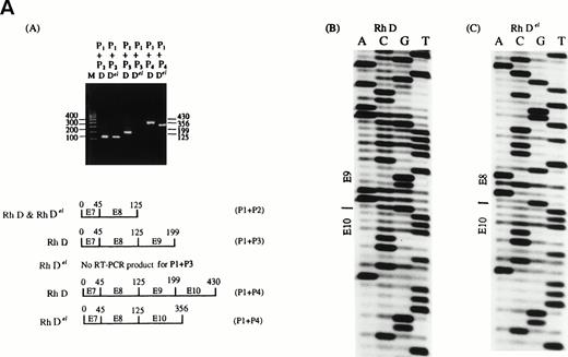 Fig. 1. (A) By using different pairs of RH D specific primers and nested RT-PCR to amplify the RH Del gene, there was a deletion of exon 9 of RH Del gene (a). The results were further confirmed by direct sequencing of the nested RT-PCR product (b) and (c). The sequences of primers P1, P2, P3 and P4 are shown in the text. (B) The breakpoint region sequence of Del in comparison with D, Ce, and ce alleles.