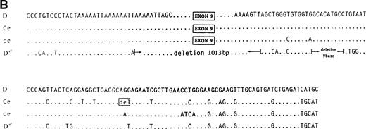 Fig. 1. (A) By using different pairs of RH D specific primers and nested RT-PCR to amplify the RH Del gene, there was a deletion of exon 9 of RH Del gene (a). The results were further confirmed by direct sequencing of the nested RT-PCR product (b) and (c). The sequences of primers P1, P2, P3 and P4 are shown in the text. (B) The breakpoint region sequence of Del in comparison with D, Ce, and ce alleles.