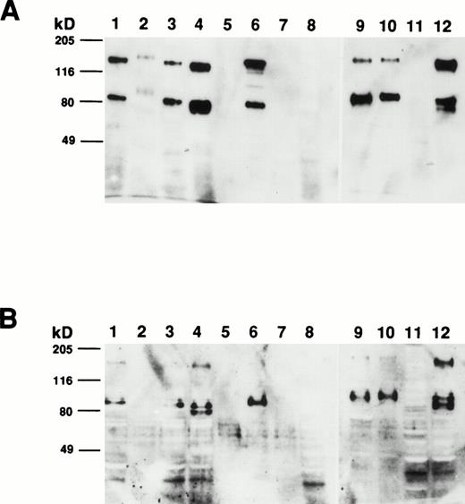 Fig. 8. Determination of the molecular mass of the CSM identified by MoAb 103B2/9E10. Membrane preparations from a variety of hematopoietic and nonhematopoietic cell lines/preparations were separated by 10% SDS-polyacrylamide gel electrophoresis under nonreducing and reducing conditions and transferred to nitrocellulose. The filters were successively incubated with 103B2/9E10 MoAb supernatant and antimouse-HRPO, and the immunoreactive proteins were detected by ECL as described in Materials and Methods. Under nonreducing conditions (A), MoAb 103B2/9E10 identifies two differentially migrating species with an estimated molecular mass of 80 and 160 kD. However, upon reduction (B), the lower migrating 80-kD band is the major immunoreactive protein. (A and B) Lane 1, KG1a (progenitor cell line); lane 2, HL-60 (promyelocytic cell line); lane 3, Hel-DR (erythroleukemic); lane 4, K562 (erythroleukemic); lane 5, red blood cells; lane 6, Mo7e (megakaryocyte); lane 7, Jurkat (T-cell line); lane 8, CD19+ B cells; lane 9, HBMSCs; lane 10, human umbilical vein endothelial cells (HUVECs); lane 11, T1 (keratinocytes); lane 12, MG63 (osteosarcoma cell line).
