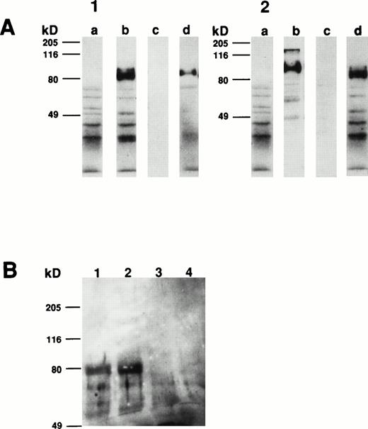 Fig. 10. Western blot and immunoprecipitation analysis of transfectant-derived recombinant CD164 protein. Membrane extracts isolated from FDC-P1 cells selected with the 105.A5 and 103B2/9E10 MoAbs (105.A5 and 103B2/9E10 FDC-P1 clones) were separated by 10% SDS-polyacrylamide gel electrophoresis under reducing conditions and transferred to nitrocellulose. The filters were successively incubated with either the 103B2/9E10 (panel 1) or 105.A5 MoAb (panel 2) supernatant (or isotype-matched, nonbinding controls), antimouse-HRPO and the immunoreactive proteins were detected by ECL as described in Materials and Methods. Under reducing conditions, MoAbs 103B2/9E10 and 105.A5 identify similar recombinant proteins of 80 kD. (A1) and (A2) contain reduced 103B2/9E10 and 105.A5 FDC-P1 protein blotted, respectively. Lanes (a) IgG3 negative control, (b) MoAb 103B2/9E10, (c) IgM negative control, and (d) MoAb 105.A5. (B) Biotinylated membrane preparations of FDC-P1 cells expressing CD164 (ie, 103B2/9E10 and 105.A5-selected FDC-P1 cells) were coincubated with the indicated MoAb for 16 hours at 4°C. Immune complexes were precipitated using goat antimouse sepharose, resuspended in reducing SDS-PAGE buffer, resolved on a 7.5% SDS-polyacrylamide gel, and visualized with biotin-streptavidin-HRPO complex and ECL. MoAb 103B2/9E10 immunoprecipitate a protein of the appropriate molecular mass from lysates derived from both 105.A5 and 103B2/9E10 FDC-P1 cells. Lane 1, 103B2/9E10 FDC-P1 lysate immunoprecipitated with MoAb 103B2/9E10; lane 2, 105.A5 FDC-P1 lysate immunoprecipitated with MoAb 103B2/9E10; lane 3, 103B2/9E10 FDC-P1 lysate immunoprecipitated with IgG3 negative control; lane 4, 105.A5 FDC-P1 lysate immunoprecipitated with IgM negative control.