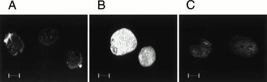 Fig. 7. The binding of soluble human FN to MK. Guinea pig MK were incubated with human plasma FN in solution at 37°C for 2 hours. The MK were then allowed to settle on FN-coated coverslips immunostained with antihuman FN antibody, IST-4, which does not cross-react with guinea pig FN, or an anti-FN EIIIb antibody, which cross-reacts with guinea pig FN. After incubation with an FITC-conjugated second antibody, immunostained MK were visualized by confocal microscopy. The binding of soluble human FN to guinea pig MK was limited to patches on the MK surface as shown in (A). (B) shows endogenous guinea pig FN throughout the MK cytoplasm. (C) is a control in which MK were incubated with nonimmune normal IgG.