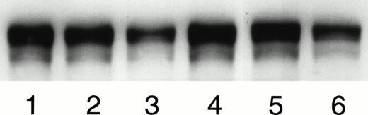 Fig. 8. The demonstration of the inhibition of the binding of soluble human FN to MK by Western blotting: Guinea pig MK were incubated with human plasma FN in solution at 37°C for 2 hours. FN bound to the MK surface was extracted, separated by SDS-PAGE, and visualized by ECL on Western blots with an antibody specific to human FN, IST-4. The figure shows a representative of four experiments in which MK were incubated with MK0852 (10 μmol/L; lane 1), bitistatin (2 μmol/L; lane 2), EMF10 (50 nmol/L; lane 3), control without integrin blockers (lane 4), HP2/1 (10μg/mL; lane 5), and SAM-1 (10 μg/mL; lane 6). The densitometric analysis of the three experiments is given in the Results.