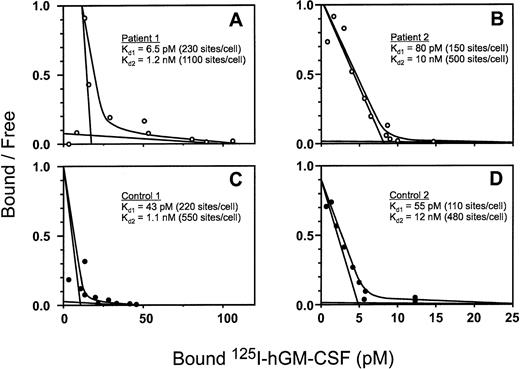 Fig. 4. Representative Scatchard plots of the binding of125I human GM-CSF specific activity to bone marrow cells from patients no. 1 (A) and 2 (B) with acquired PAP and control individuals (C and D). The calculated dissociation equilibrium binding constants for the high-affinity (Kd1) and low-affinity (Kd2) sites are given along with the mean number of sites per cell (in parentheses).