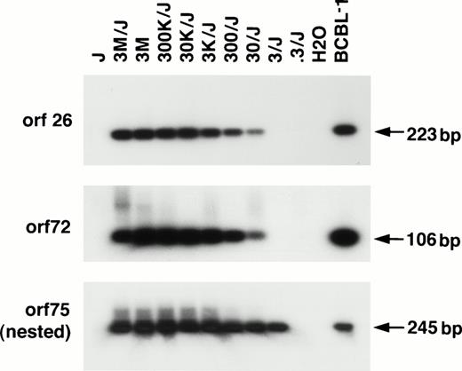 Fig. 1. Sensitivity curves for three HHV-8 PCR assays using primers from different regions of the genome followed by Southern hybridization with specific internal probes. Jurkat cell DNA (J; 2 μg/reaction) was inoculated with a known copy number of BCP-1 HHV-8 DNA starting at 3 million (M) to 0.3 genome copies along with amplification of BCBL-1, another HHV-8–containing cell line. Jurkat cell DNA as well as water (H2O) were simultaneously amplified. Non-nested amplification in the orf 26 and orf 72 region were able to detect 30 genome copies per reaction. With longer exposure, 3 genome copies could be reproducibly detected without nesting using the orf 26 primers. Nested amplification in the orf 75 region could reproducibly detect 3 genome copies per reaction.