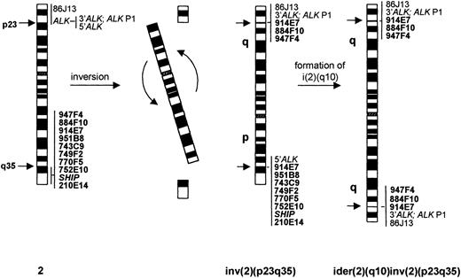 Fig. 4. Schematic representation of the normal chromosome 2, inv(2)(p23q35), and ider(2)(q10) inv(2)(p23q35), together with the FISH pattern of applied probes.