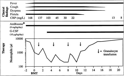 Fig. 3. Clinical course during the first 3 weeks post-BMT. CRP, C reactive protein; G-CSF, granulocyte-colony stimulating factor; BMT, bone marrow transplantation.