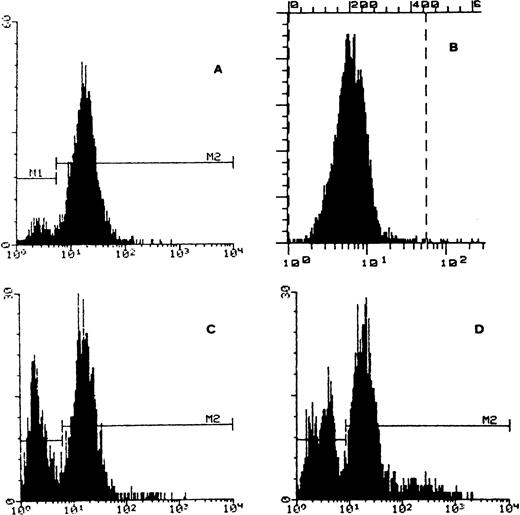 Fig. 4. FACS analysis of cytochrome b558 on granulocyte membrane. (A) Control: normal granulocytes expressing cytochrome b558. (B) Patient’s granulocytes before BMT negative for cytochrome b558. (C) Patient’s sister (heterozygous carrier and bone marrow donor) presenting two distinct granulocyte populations, negative and positive for cytochrome b558. (D) Patient after BMT with two granulocyte populations negative and positive for cytochrome b558.