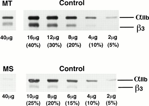 Fig. 1. Immunoblot analysis of platelet proteins from patients MT and MS using anti-IIbβ3 antibodies. Platelet proteins from GT patients MT and MS and various amounts of control platelet proteins from three normal subjects were electrophoresed on 7.5% polyacrylamide gel under reducing conditions and transferred to a nitrocellulose membrane. IIb and β3 were detected with a 1:10,000 dilution of rabbit anti-IIbβ3 antibodies. The amount of proteins electrophoresed is indicated at the bottom of each line.