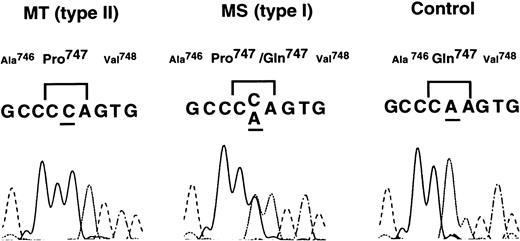 Fig. 2. Nucleotide sequence analysis of IIb cDNA from patients MT and MS. Nucleotides of IIb cDNA from patients MT and MS and normal control were amplified by RT-PCR. The amplified fragments were directly examined using Taq DyeDeoxy Terminator Cycle Sequencing kit, and samples were run and analyzed on an ABI 373A DNA sequencer.