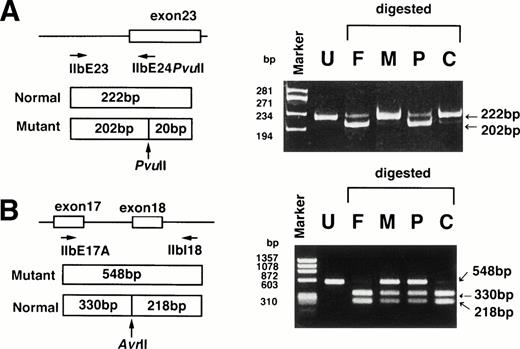 Fig. 4. ASRA. (A) The region around exon 23 of the IIb gene was amplified by PCR using primers IIbE23 and IIbE24Pvu II, followed by digestion with PvuII. The A → C substitution creates a restriction site forPvu II and yields 202-bp and 20-bp fragments. The resulting fragments were electrophoresed in a 6% polyacrylamide gel. (B) The region around exon 18 of the IIb gene was amplified by PCR using primers IIbE17A and IIbI18, followed by digestion withAvr II. Avr II digestion of the PCR products yields 330-bp and 218-bp fragments in the normal allele. The G → A substitution abolished a restriction site for Avr II. The resulting fragments were electrophoresed in a 1.5% agarose gel. F, M, P, and C denote DNA from the patient’s father, mother, patient (MS), and control, respectively. Undigested PCR fragment from the control is also shown (U). Marker: ◊X174 digested with Hae III.