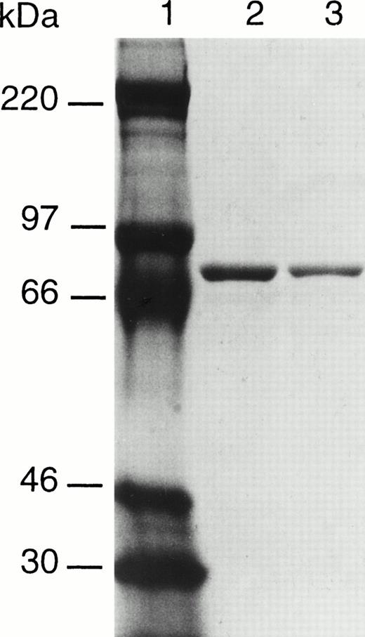 Fig. 2. SDS-PAGE analysis of purified recombinant factor XIII A subunits. Lane 1, molecular weight makers; lane 2, factor XIII 34Val; lane 3, factor XIII 34Leu.