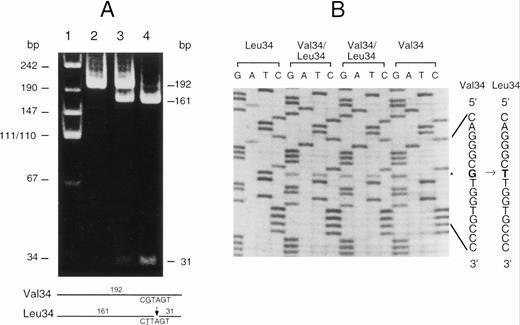 Fig. 3. (A) PCR-RFLP analysis of the Val34Leu polymorphism in exon II of the factor XIII A subunit gene. The fragment amplified from exon II was digested with Dde I. This fragment is 192 bp in length and does not normally contain a Dde I site in either allele. The Dde I site was selectively introduced into the Leu34 allele by the use of a modified primer (see Materials and Methods). Lane 1, molecular size markers; lane 2, DNA from a Val34 homozygote; lane 3, DNA from a Val34/Leu34 heterozygote; lane 4, DNA from a Leu34 homozygote. The expected sizes of the DNA fragments after digestion are shown on the right and schematically at the bottom of the figure. (B) Direct sequencing of amplified exon II from individuals with each genotype. The Val34 and Leu34 sequences are given on the right. The substituted nucleotide G to T causing the Val34Leu substitution is shown in bold type and the position of the base substitution is marked (*).