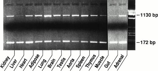 Fig. 2. Tissue distribution of vWF mRNA in murine tissues. Competitive RT-PCR was performed using 1 μg of RNA from each tissue and 1 × 104 molecules of cRNA standard. The top band (1,130 bp) is the PCR product derived from the endogenous vWF mRNA and the bottom band (172 bp) is from the cRNA standard. The difference in the expression of vWF mRNA among murine tissues can be approximated by comparing the intensity of the endogenous mRNA bands.