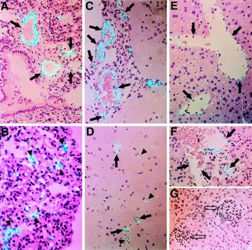 Fig. 4. Differential expression of vWF mRNA in ECs from different tissues. The relative level of expression of vWF mRNA in murine tissues was compared by in situ hybridization. (A) and (B) show the lung at an original magnification of × 250 (A) and × 400 (B). Arrows denote pulmonary arteries and veins. Arrowheads indicate microvascular ECs surrounding alveoli. (C) and (D) show brain (original magnification × 250). Arrows in (C) denote cerebral arteries and veins. Arrows in (D) indicate small vessels. Arrowheads denote microvessels in the cerebral cortex. (E) shows a section of liver (original magnification × 250). Arrows indicate hepatic veins. (F) and (G) show sections of kidney (original magnification × 250). Solid arrows denote renal arteries and veins; open arrows indicate glomeruli. All slides were exposed for 12 weeks.