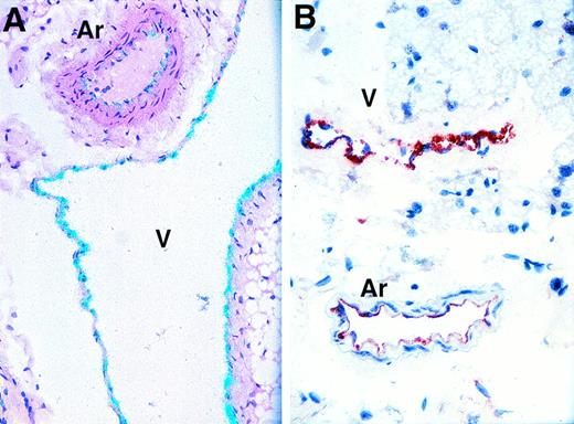Fig. 5. Differential expression of vWF mRNA and antigen in arteries and veins. Analysis of subcutaneous adipose tissue by in situ hybridization for vWF mRNA (A; original magnification × 250) or by immunohistochemistry for vWF antigen (B; original magnification × 250). The in situ hybridization slide was exposed for 8 weeks.