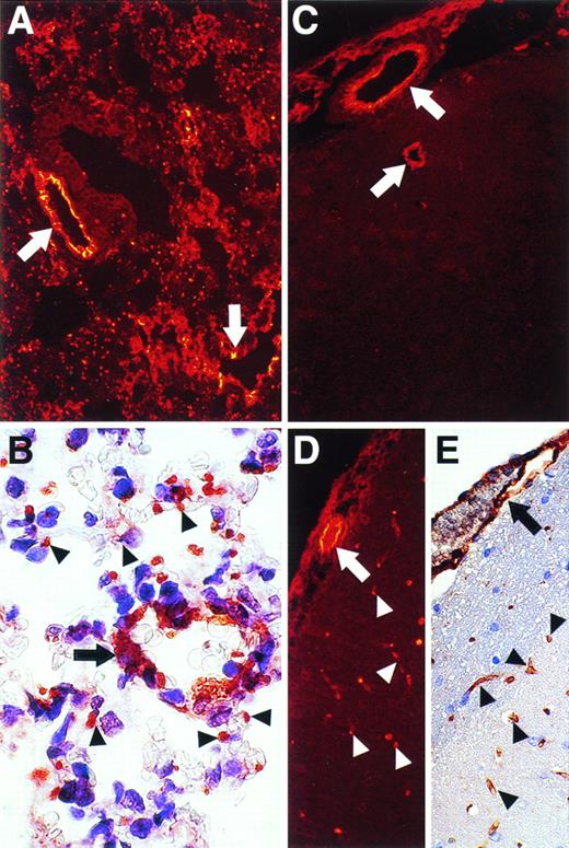 Fig. 6. Immunohistochemical and/or immunofluorescent staining analysis for vWF and albumin antigens and for LEA lectin in the lung and brain. Sections of murine lung (A and B) and brain (C, D, and E) were analyzed for vWF antigen (A, B, and C), for albumin (D), and for LEA lectin (E). Staining was visualized by immunofluorescence (A, C, and D) or regular immunohistochemistry (B and E). Arrows denote larger vessels, whereas arrowheads denote microvascular ECs surrounding aveoli in the lung (B) or present in the brain (C, D, and E). Original magnifications: for (A), (C), (D), and (E), ×250; for (B), ×1,000.
