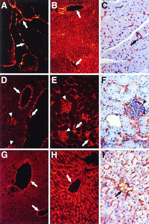 Fig. 7. Immunohistochemical and/or immunofluorescent staining analysis for vWF and albumin antigens and for LEA lectin in the heart, kidney, and liver. Sections of murine heart (A, B, and C), kidney (D, E, and F), and liver (G, H, and I) were analyzed for vWF (A, D, and G) or albumin (B, E, and H) antigens and for LEA lectin (C, F, and I). Staining was visualized by immunofluorescence (A, B, D, E, G, and H; original magnification × 250) or immunohistochemistry (C, F, and I; original magnification × 400). Arrows in (A) denote endocardium. In other panels, arrows denote relatively large vessels, whereas arrowheads denote glomerular ECs.