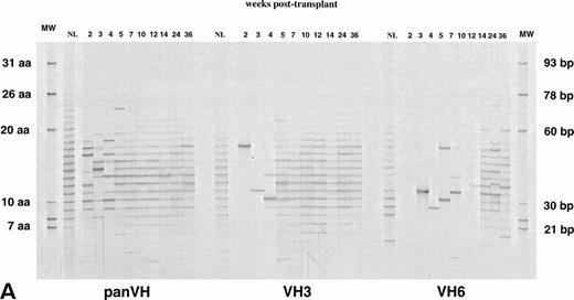 Fig. 1. IgM H CDR3 fingerprinting after (A) allogeneic BMT (patient no. 1), (B) autologous PBSCT (patient no. 9), and (C) CD34 selected autologous PBSCT (patient no. 11). IgM H CDR3s were amplified in PCRs using PBMC cDNA as described in Materials and Methods. The Ig H panVH (consensus) primer, VH3 primer, or VH6 primer was used in combination with the Cμ primers to obtain panVH, VH3, or VH6 fingerprinting profiles, respectively. PCR products were run on 5% polyacrylamide sequencing gels that result in resolution of CDR3s according to basepair size. Therefore, each band in fingerprinting corresponds to a certain CDR3 size. Molecular markers (MW) are provided of known basepair size and the corresponding number of encoded aa. Bands are separated from each other by 3 bp because of the abundance of in-frame Ig transcripts in total RNA. Nevertheless, violation of 3-bp spacing of bands can be seen occasionally. The numbers above the lanes indicate the number of weeks when the blood samples were collected posttransplant. Lanes marked NL show the H CDR3 profiles of a normal donor. The number of bands in each lane correlates directly with the repertoire diversity. The band intensity reflects the total amount of CDR3 transcripts that comprise the band. The band intensities are comparable to each other within a lane. Absolute lymphocyte counts per microliter at corresponding weeks were as follows: (A) 10 (2 weeks), 136 (3 weeks), 196 (4 weeks), 398 (5 weeks), 1,175 (7 weeks), 1,479 (10 weeks), 1,295 (12 weeks), 627 (14 weeks), 910 (24 weeks), and 1,240 (36 weeks); (B) 200 (2 weeks), 500 (4 weeks), 1,918 (6 weeks), 1,500 (19 weeks), and 1,231 (36 weeks); (C) 19 (2 weeks), 200 (3 weeks), 700 (4 weeks), 400 (6 weeks), 1,000 (7 weeks), and 1,100 (26 weeks). Shown are IgM fingerprinting profiles representative of 11 patients and normal donors of allogeneic BMT recipients.