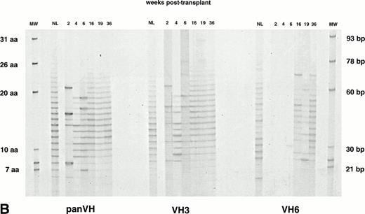 Fig. 1. IgM H CDR3 fingerprinting after (A) allogeneic BMT (patient no. 1), (B) autologous PBSCT (patient no. 9), and (C) CD34 selected autologous PBSCT (patient no. 11). IgM H CDR3s were amplified in PCRs using PBMC cDNA as described in Materials and Methods. The Ig H panVH (consensus) primer, VH3 primer, or VH6 primer was used in combination with the Cμ primers to obtain panVH, VH3, or VH6 fingerprinting profiles, respectively. PCR products were run on 5% polyacrylamide sequencing gels that result in resolution of CDR3s according to basepair size. Therefore, each band in fingerprinting corresponds to a certain CDR3 size. Molecular markers (MW) are provided of known basepair size and the corresponding number of encoded aa. Bands are separated from each other by 3 bp because of the abundance of in-frame Ig transcripts in total RNA. Nevertheless, violation of 3-bp spacing of bands can be seen occasionally. The numbers above the lanes indicate the number of weeks when the blood samples were collected posttransplant. Lanes marked NL show the H CDR3 profiles of a normal donor. The number of bands in each lane correlates directly with the repertoire diversity. The band intensity reflects the total amount of CDR3 transcripts that comprise the band. The band intensities are comparable to each other within a lane. Absolute lymphocyte counts per microliter at corresponding weeks were as follows: (A) 10 (2 weeks), 136 (3 weeks), 196 (4 weeks), 398 (5 weeks), 1,175 (7 weeks), 1,479 (10 weeks), 1,295 (12 weeks), 627 (14 weeks), 910 (24 weeks), and 1,240 (36 weeks); (B) 200 (2 weeks), 500 (4 weeks), 1,918 (6 weeks), 1,500 (19 weeks), and 1,231 (36 weeks); (C) 19 (2 weeks), 200 (3 weeks), 700 (4 weeks), 400 (6 weeks), 1,000 (7 weeks), and 1,100 (26 weeks). Shown are IgM fingerprinting profiles representative of 11 patients and normal donors of allogeneic BMT recipients.
