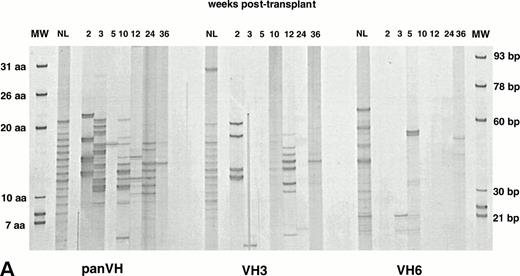 Fig. 4. IgG H CDR3 fingerprinting after (A) allogeneic BMT (patient no. 1), (B) autologous PBSCT (patient no. 9), and (C) CD34 selected autologous PBSCT (patient no. 11). IgG panVH, VH3, and VH6 H CDR3 fingerprinting profiles were obtained as described in Fig 1 and Materials and Methods. Cγ primers were used instead of Cμ primers to amplify H CDR3s in PCRs. MWs are provided of known basepair size and the corresponding number of encoded aa. The numbers above the lanes indicate the number of weeks when the blood samples were collected posttransplant. Absolute lymphocyte counts at corresponding weeks are as shown in Fig 1. Lanes marked NL show the IgG H CDR3 profiles of a normal donor. IgG H CDR3 repertoire reconstitution was significantly delayed posttransplant. Shown are IgG fingerprinting profiles representative of 11 patients and normal donors of allogeneic BMT recipients.