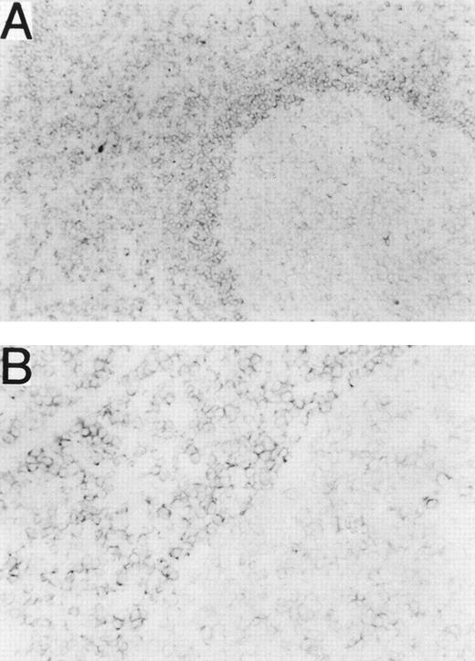 Fig. 6. RP105 is mainly expressed on B cells in mantle zones. Frozen sections from a human tonsil were stained with the MHR73 MoAb. (A) RP105+ B cells are mainly located in a mantle zone that surrounds a germinal center where expression of RP105 is dull or negative (original magnification × 50). (B) Higher magnification (original magnification × 200) of a boundary between the mantle zone and the germinal center of (A). No significant signal was observed by staining with the second reagent alone.