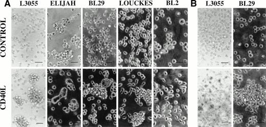 Fig. 1. Phase contrast photomicrographs of BL cell lines cultured at 37°C for 72 hours either alone (control) or with CD40L (1 μg/mL). Cell clumping was observed either after (A) the initial 72-hour treatment time or (B) after a total 10 days of culture, which included the initial 72-hour treatment. For all experiments in which cells were pretreated with reagents, cells at 5 × 105/mL received an initial culture with CD40L (with or without IL-4) for time stated and were then washed free of stimulants before replating at 5 × 105/mL in fresh culture medium in the absence of stimulants. The scale bar represents 50 μm.