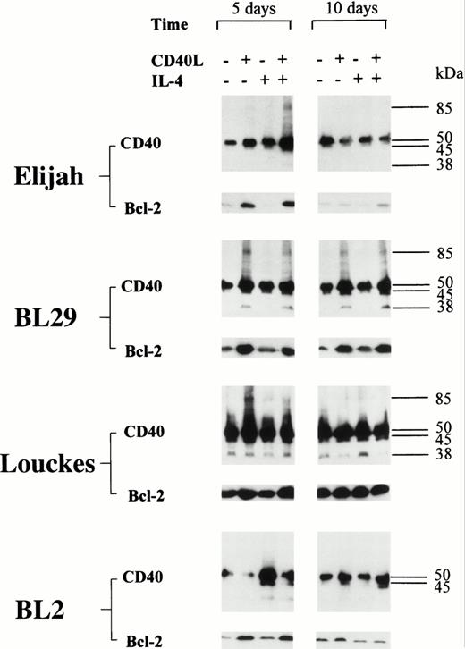 Fig. 6. BL cell lines were incubated either alone or with CD40L, IL-4, or CD40L with IL-4 for 72 hours. Cell lysates were prepared at either 5 or 10 days (including the initial 72-hour stimulation time), and equal amounts of total cellular protein was resolved on 10% SDS-PAGE. Western blotting was performed to determine the presence of CD40 homodimers using anti-CD40 MoAb G28.5. In addition, the same lysates were resolved on 12.5% SDS-PAGE, and Western blotting was performed to detect the presence of Bcl-2 using anti–Bcl-2 MoAb 100. The numbers to the right of each panel set indicate the positions of molecular weight markers.