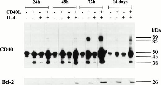 Fig. 7. L3055 cells were incubated either alone or with CD40L, IL-4, or CD40L with IL-4 for 72 hours. During the 72-hour stimulation time, the presence of CD40 homodimers and Bcl-2 was determined at 24, 48, and 72 hours. Immunoblots were also performed after cells were incubated with the same additives for 72 hours, followed by an extended 14-day culture (including the initial 72-hour stimulation time) in normal complete medium. Cell lysates were prepared and equal amounts of total cellular protein resolved on either 10% SDS-PAGE for CD40 homodimers or 12.5% SDS-PAGE for Bcl-2. Western blots were performed and CD40 homodimers were detected used anti-CD40 MoAb G28.5. Bcl-2 was detected using anti-Bcl-2 MoAb 100. The numbers to the right of each panel group indicate the positions of molecular weight markers.