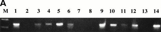 Fig. 1. RT-PCR amplification of IgH VDJ using consensus primers from single BM plasma cells of a myeloma patient. (A) Individual BM plasma cells from patient 2 were purified, stained, and sorted into PCR tubes containing lysis buffer, followed by reverse transcription and seminested amplification of IgH VDJ mRNA using consensus primers to FR2 and Jh as indicated in methods. Product was amplified from 10 of 14 plasma cells (lines 1-14) (M: molecular weight marker − 100 bp ladder). (B) Individual BM plasma cells from patient 2 were purified, stained, and sorted into PCR tubes containing lysis buffer, followed by reverse transcription and nested amplification of IgH VDJ mRNA first using consensus primers to FR2 and Jh and next using specific primers to CDR2 and CDR3 regions of clonotypic IgH for patient 2. Product was amplified from 12 of 14 plasma cells (lines 1-14) (M: molecular weight marker − 100 bp ladder).