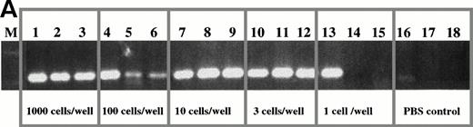 Fig. 4. Limiting dilution analysis of freshly isolated PBMC from patient 1 and 19 using PSA. (A) Limiting dilution assay of PBMC from patient 1. The number of cells indicated in the figure were added to PCR tubes, reverse transcribed, and amplified in PSA with patient-specific primers. The transcripts in each tube were amplified in nested PCR using consensus primers to FR2 and Jh1 followed by a second amplification using patient-specific CDR2 and CDR3 primers. Of three tubes containing one cell, one was positive and two were negative suggesting an approximate concentration of the clonotypic cells in the blood of about 33%. The number of B cells as measured by flow cytometry for an aliquot of the same PBMC sample was 35%. This PBMC sample is the same as that described in Table 3, line 2, where clonotypic cells represented 18% of PBMC as measured by in situ RT-PCR on sorted B cells. (B) Limiting dilution of fresh PBMC from patient 19. IgH transcripts were amplified using VH3 family specific,40and Jh consensus primers, followed by patient-specific CDR2 and CDR3 primers in nested PCR. For this patient, 2 of 3 tubes were positive at the concentration of three cells per well (with 37% negative tubes at this concentration, the approximate frequency of clonotypic cells is one in every three PBMC, based on Poisson statistics), and 2 of 3 positive at one cell per well. By flow cytometry, patient 19 had 34% B cells in the PBMC samples used for the limiting dilution assay. (C) Clonotypic IgH transcripts at one cell per tube from patient 19. To more accurately determine the number of clonotypic cells, 96 tubes of one cell/tube were analyzed and 24 were positive (25%), as shown in the figure. With 75% negative tubes at this concentration, the chances of a given tube receiving more than one clonotypic cell are very low.