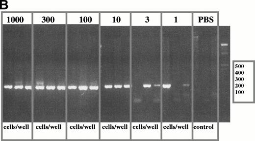 Fig. 4. Limiting dilution analysis of freshly isolated PBMC from patient 1 and 19 using PSA. (A) Limiting dilution assay of PBMC from patient 1. The number of cells indicated in the figure were added to PCR tubes, reverse transcribed, and amplified in PSA with patient-specific primers. The transcripts in each tube were amplified in nested PCR using consensus primers to FR2 and Jh1 followed by a second amplification using patient-specific CDR2 and CDR3 primers. Of three tubes containing one cell, one was positive and two were negative suggesting an approximate concentration of the clonotypic cells in the blood of about 33%. The number of B cells as measured by flow cytometry for an aliquot of the same PBMC sample was 35%. This PBMC sample is the same as that described in Table 3, line 2, where clonotypic cells represented 18% of PBMC as measured by in situ RT-PCR on sorted B cells. (B) Limiting dilution of fresh PBMC from patient 19. IgH transcripts were amplified using VH3 family specific,40and Jh consensus primers, followed by patient-specific CDR2 and CDR3 primers in nested PCR. For this patient, 2 of 3 tubes were positive at the concentration of three cells per well (with 37% negative tubes at this concentration, the approximate frequency of clonotypic cells is one in every three PBMC, based on Poisson statistics), and 2 of 3 positive at one cell per well. By flow cytometry, patient 19 had 34% B cells in the PBMC samples used for the limiting dilution assay. (C) Clonotypic IgH transcripts at one cell per tube from patient 19. To more accurately determine the number of clonotypic cells, 96 tubes of one cell/tube were analyzed and 24 were positive (25%), as shown in the figure. With 75% negative tubes at this concentration, the chances of a given tube receiving more than one clonotypic cell are very low.