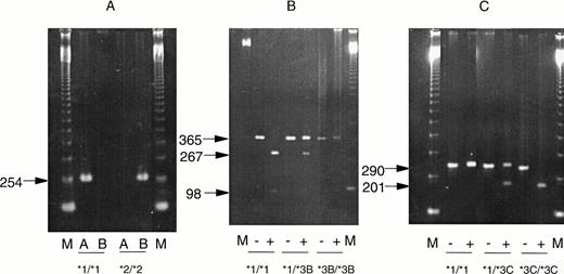 Fig. 3. Results of PCR assays for mutations at position G238C (A), G460A (B), and A719G (C). Photographs of ethidium bromide-stained gels are shown. “M” represents marker lanes. In (A) “A” indicates the result with wild-type and “B”, the result with mutation-specific primers. In (B and C), “−” indicates the result before digestion and “+” after digestion with restriction enzymes, as descibed in Materials and Methods. Homozygous mutated DNA was obtained from cases with absent TPMT activity not included in the present study.