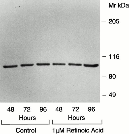 Fig. 2. Immunoblot of TOPO I levels using antibody C2126 in control and RA-treated HL-60 cells.