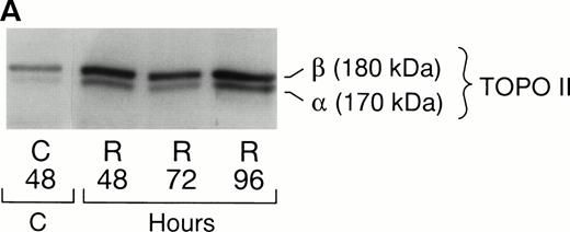 Fig. 4. (A) Immunoblot analysis of TOPO II and β levels using serum IID (15) in control (C) and RA (R)-treated HL-60 cells. (B) Analysis of TOPO II and β protein levels by measurement of optical density.