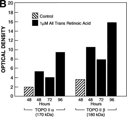 Fig. 4. (A) Immunoblot analysis of TOPO II and β levels using serum IID (15) in control (C) and RA (R)-treated HL-60 cells. (B) Analysis of TOPO II and β protein levels by measurement of optical density.