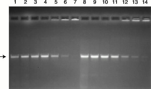 Fig. 7. Analysis of decatenating activity in nuclear extracts from control (lanes 1 through 7) and RA-treated (lanes 8 through 14) HL-60 cells. The substrate 200 ng kDNA (TOPOGEN Inc) was incubated for 30 minutes with nuclear extracts that were serially diluted to contain the following: lanes 1 and 8 (1:2), lanes 2 and 9 (1:4), lanes 3 and 10 (1:8), lanes 4 and 11 (1:16), lanes 5 and 12 (1:32), lanes 6 and 13 (1:64), and lanes 7 and 14 (1:128). The position of the decatenated kDNA is indicated by the arrow.