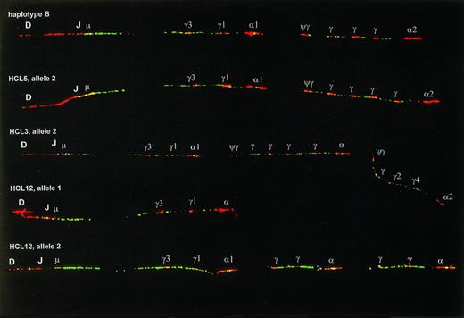 Fig. 2. Examples of CH duplication and deletion polymorphisms. The upper fiber shows haplotype B, which has an extra Cγ signal in the 3′ cluster as compared with haplotype A (Fig1), and was present at a frequency of 37.5% in our series. The second fiber has two extra Cγ signals in the 3′ cluster. The third fiber shows an example of the second most frequent type of polymorphism, appearing as a multigene duplication. The lower two fibers are the two germline alleles of one HCL patient, allele 1 having a multigene deletion, allele 2 having a more complex pattern, probably the result of multiple deletion/duplication events. On the alleles in this figure most Cγ and C genes could not be identified and are indicated only with γ and .
