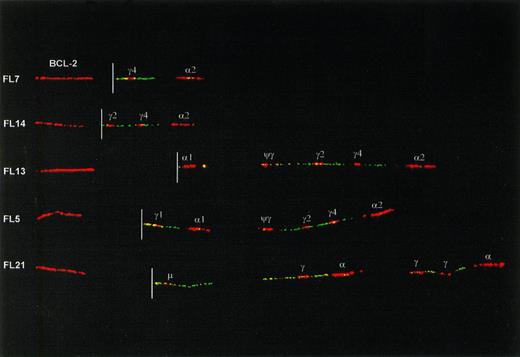 Fig. 3. Examples of class-switch rearrangements on the translocated allele of FLs, detected with a combination of IgH and BCL-2 probes. The red signal on the left side of each fiber is a BCL-2 cosmid probe located about 20 kb 5′ from the major breakpoint cluster (MBR) and 50 kb 5′ from the minor cluster region (MCR) of BCL-2. The location of the translocation breakpoint (derived from hybridizations with multiple BCL-2 probes, data not shown) is indicated with a white line. Originally, a more proximal (3′) BCL-2 cosmid was used that covers the breakpoint in case of a major breakpoint translocation. The more 5′ cosmid in this figure was used to create a gap between BCL-2 and IgH signals and hence facilitate interpretation of the IgH configuration. The upper 2 fibers show translocations with an MBR-breakpoint and with class switching to Cγ4 and Cγ2. The lower 3 fibers have translocation breakpoints in the MCR. Two of these have class switching to C1 and Cγ1, respectively. The bottom one has retained the Cμ-Cδ region but has downstream rearrangements, apparently consisting of deletion of a single Cγ gene from both the 5′ and the 3′ CHcluster.
