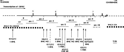 Fig. 1. BamHI restriction map of CBFA2 on chromosome 21 in the region containing the breakpoints of the t(8;21), t(3;21) and newly identified translocations involving CBFA2(vertical arrows). The breakpoint region for the t(12;21)(p13;q22) associated with childhood B-cell ALL is located 5′ of the map area. The numbered vertical bars above the line represent exons and the vertical lines below the line indicate BamHI sites. The direction of transcription is indicated by a horizontal arrow. The recombinant phage walking clones 13′ through wc-10 are indicated by horizontal lines below the map. wc-10 was not precisely mapped and is indicated by a dashed line. Genomic regions indicated by a dashed line have not been precisely mapped.