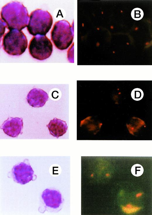 Fig. 4. FISH of sorted cells based on immunophenotype. (A), (C), and (E) show T cells (CD3+), B cells (CD19+), and NK cells (CD3−56+), respectively, and (B), (D), (F), the FISH results for these cell populations. Two signals were observed in all these cell types.