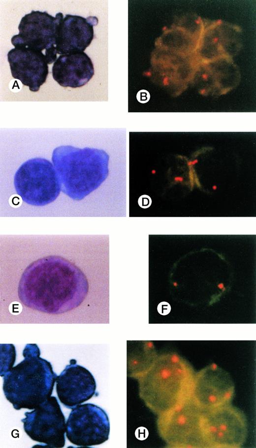Fig. 6. Cells collected by FACS and stained with May-Grünwald-Giemsa and FISH results for CD34+subpopulations. (A), (B) CD34+Thy-1+cells; (C),(D) CD34+CD19+ cells; (E),(F) CD34+7+ cells; (G),(H) CD34+CD33+ cells. Three signals were observed only in the CD34+CD33+subpopulation cells.